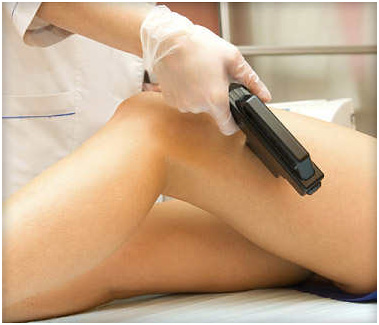 Laser Hair Removal